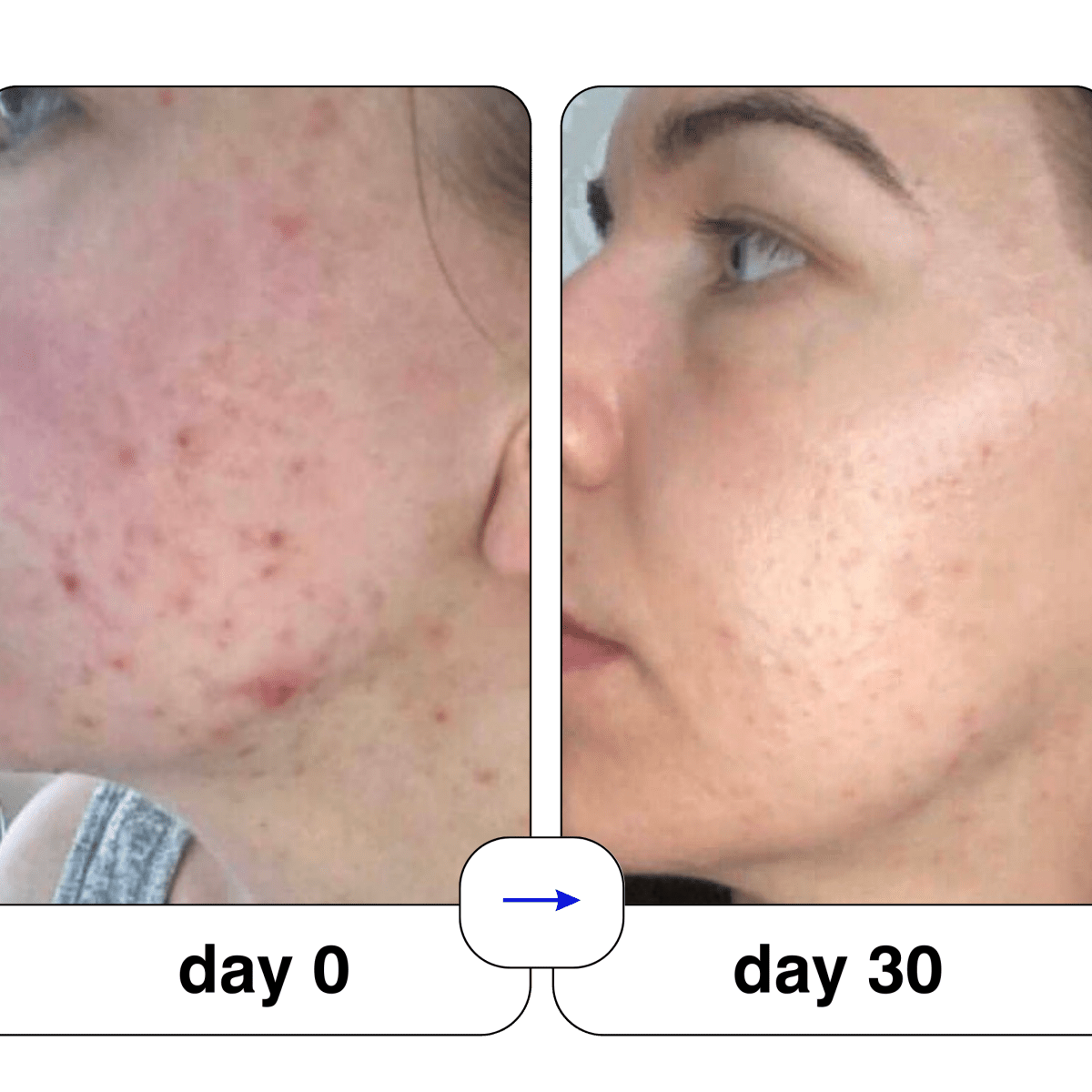 Super serum: 50ml