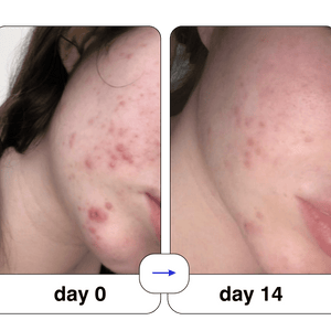 Super serum: 50ml