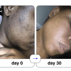 Super serum: 50ml