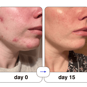 Super serum: 50ml