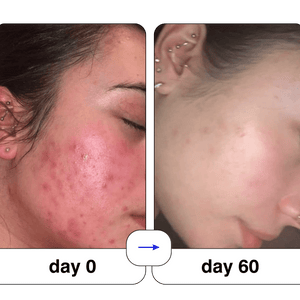 Super serum: 50ml