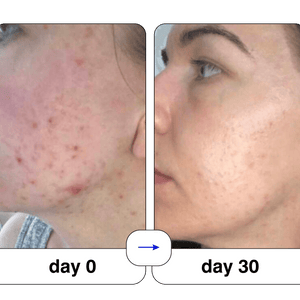 Super serum: 50ml