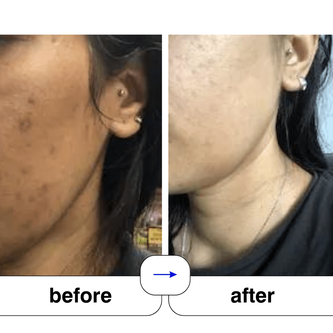 Super serum: 50ml