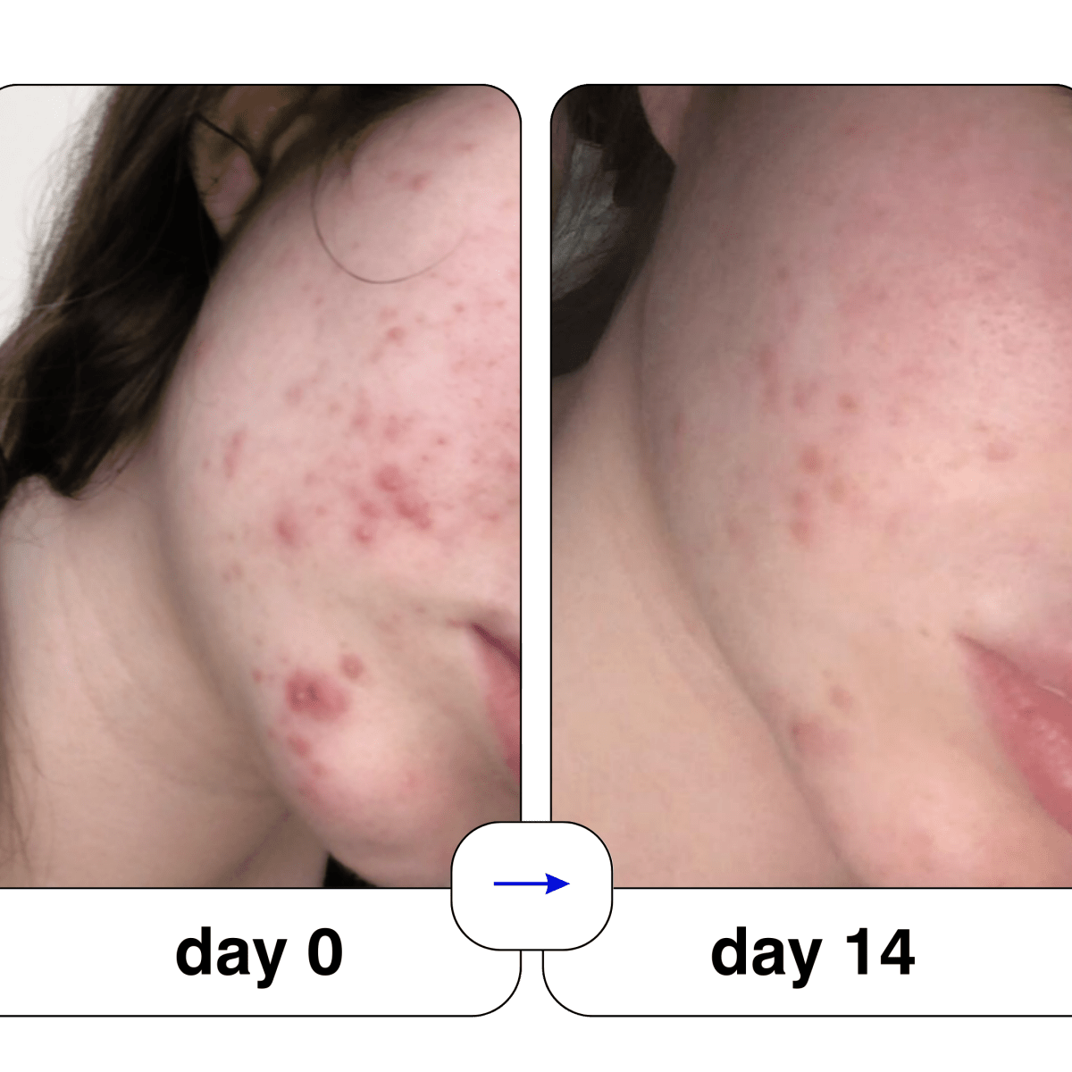 Super serum: 50ml